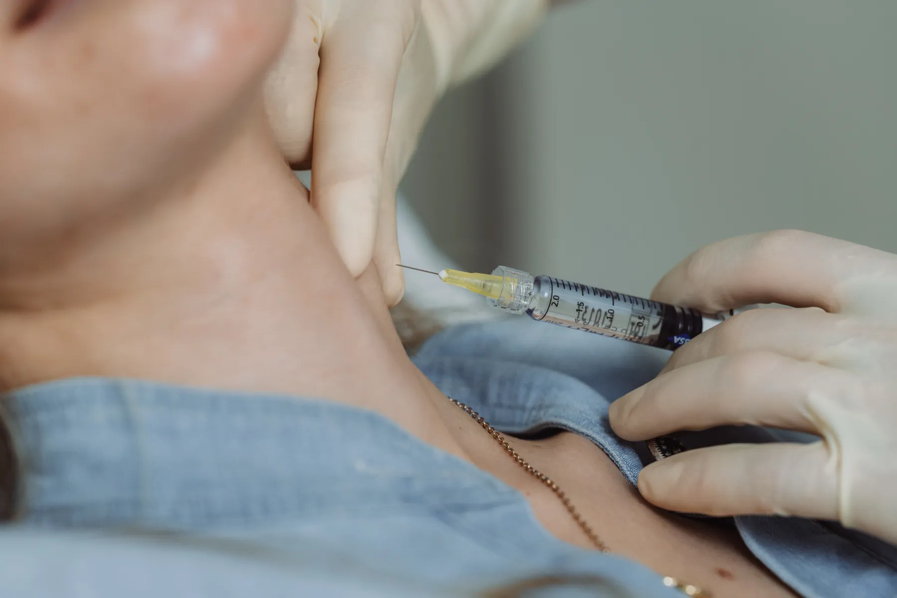 Profhilo® Behandlung in Winterthur